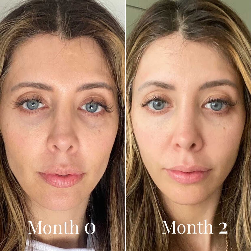 Omnilux Contour Face Mask